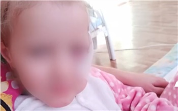 В Ачинске бродячая собака укусила за лицо 4-летнюю девочку. Следователи возбудили уголовное дело и допрашивают чиновников