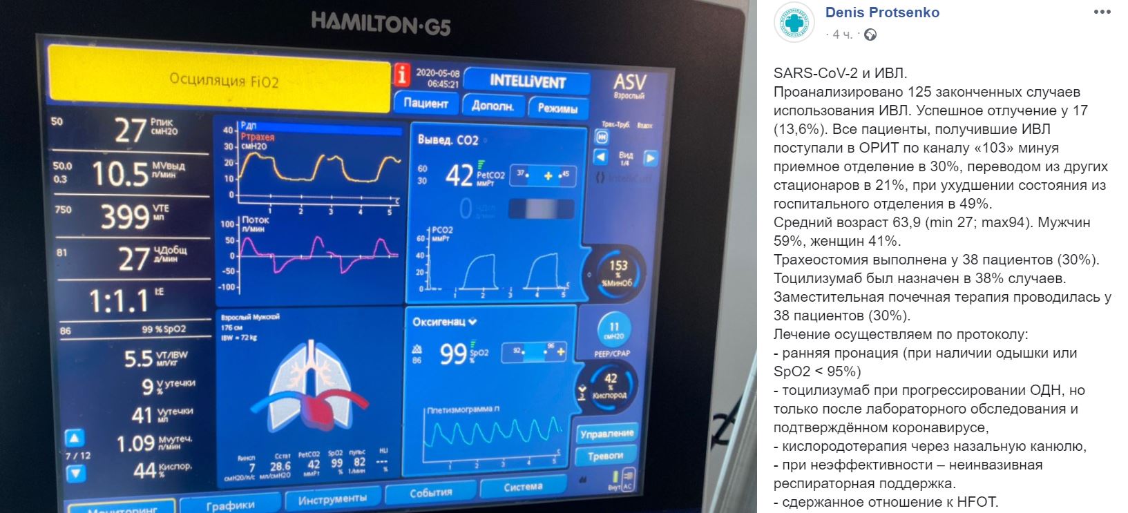 Главврач больницы в Коммунарке рассказал о статистике использования ИВЛ