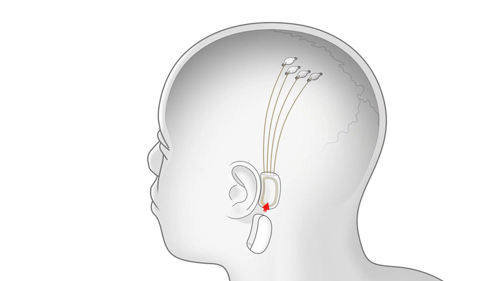 Илон Маск надеется успешно чипировать человеческий мозг в ближайший год