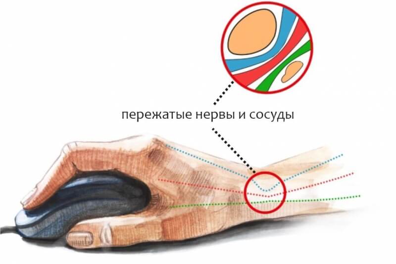 Почему вредно долго сидеть за компьютером и как это исправить